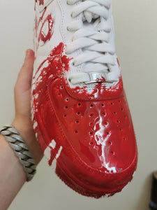 AF1 - Blood